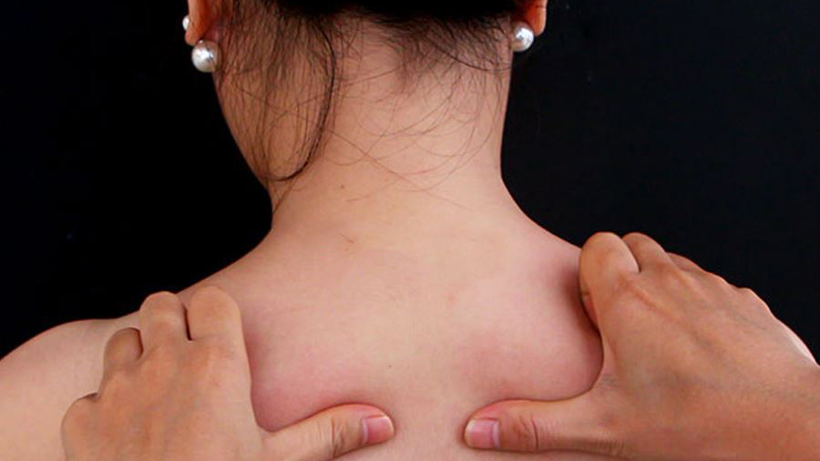 Nhận massage điều trị đau vai gáy tại nhà